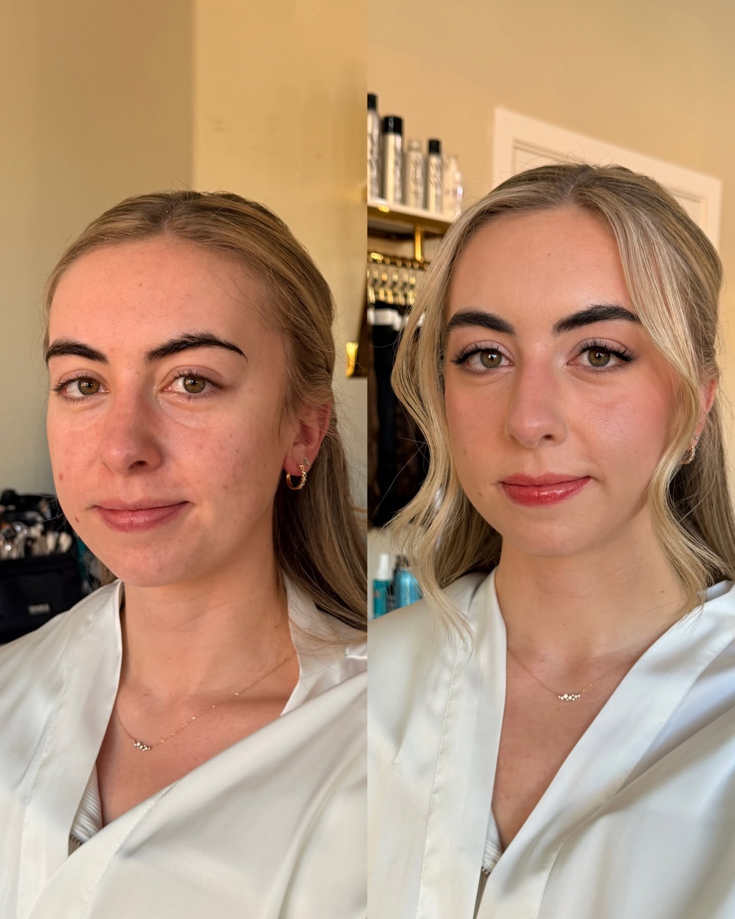 Scalp Transformation Result 5