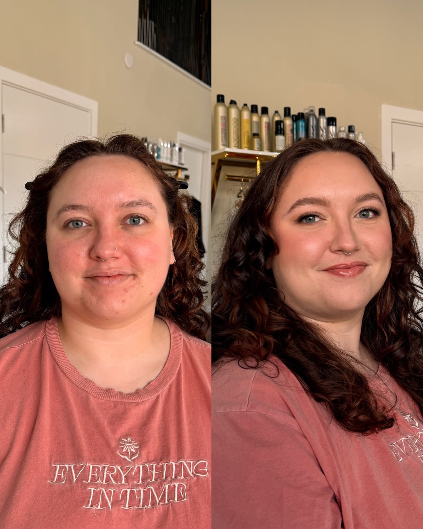 Scalp Transformation Result 4