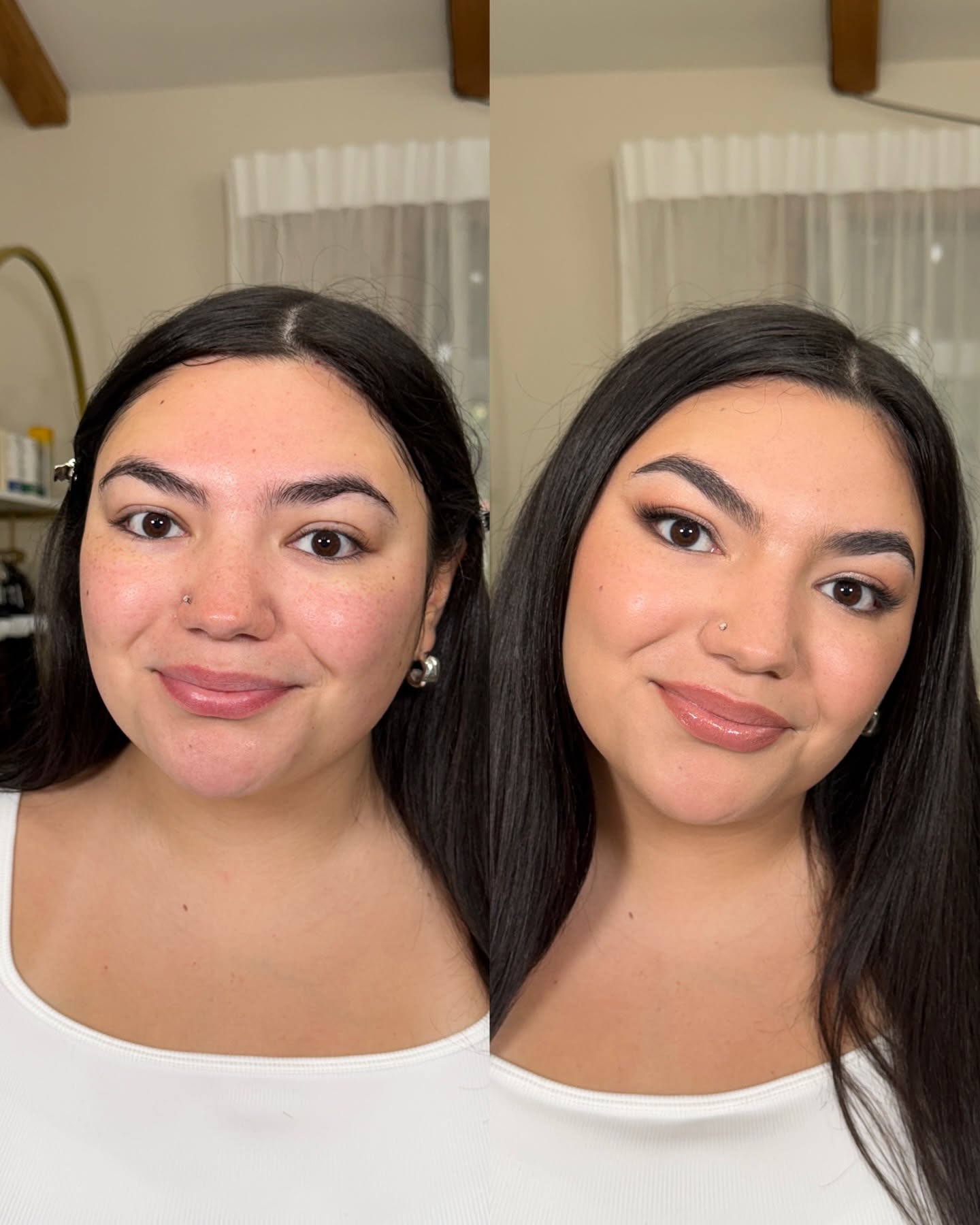 Scalp Transformation Result 1