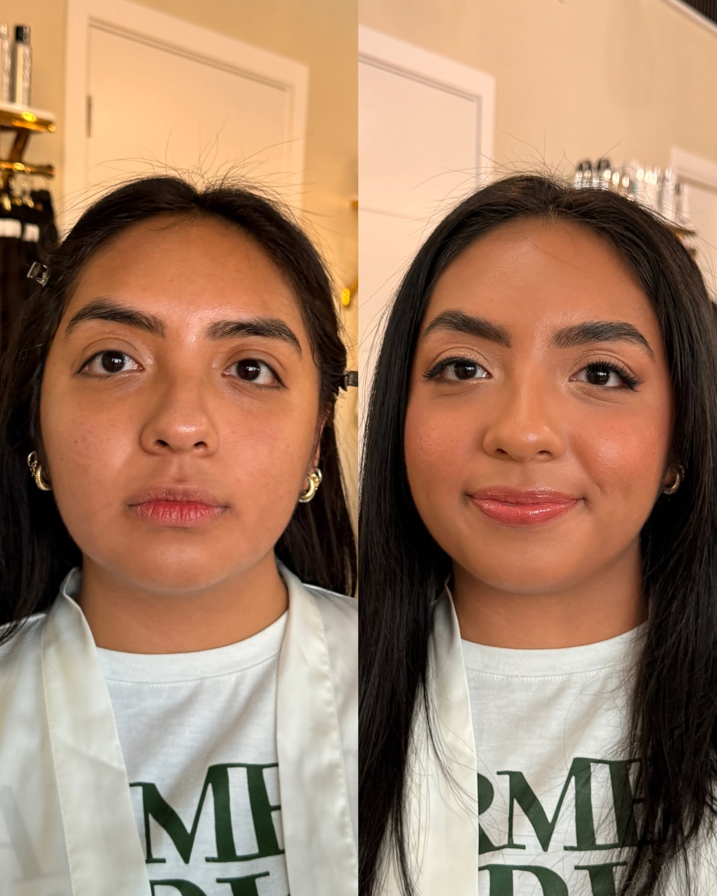 Scalp Transformation Result 3