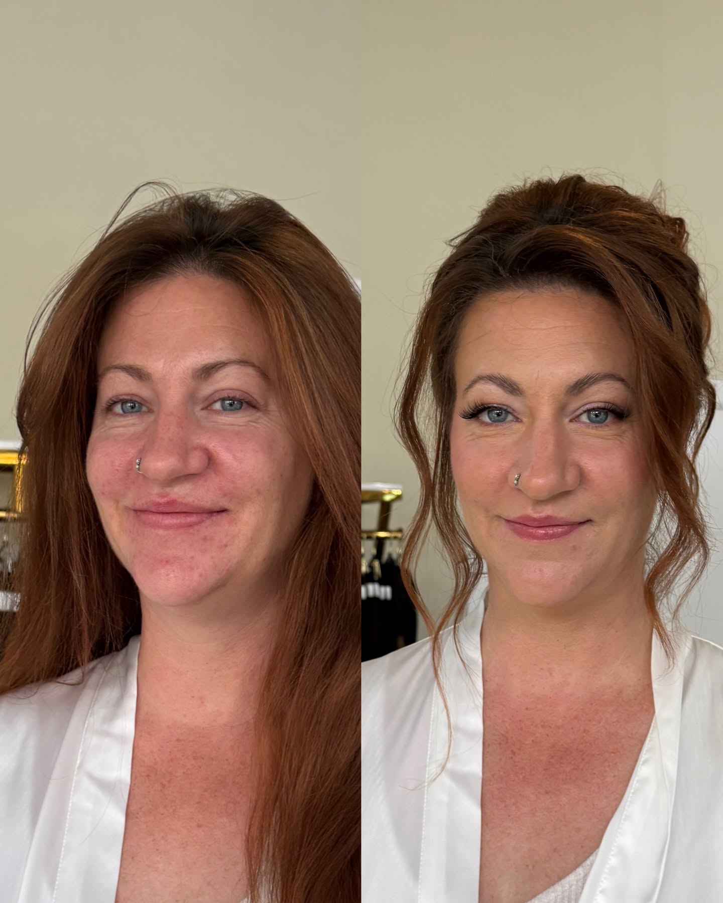 Scalp Transformation Result 2
